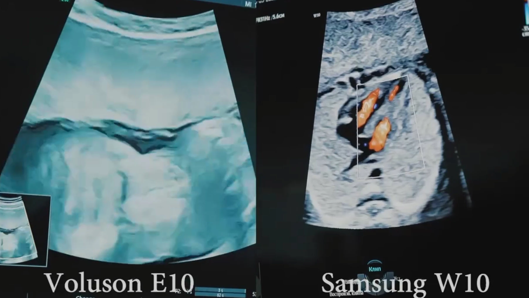 Презентация Voluson Е 10 и Samsung W 10 (г. Махачкала). Май 2022 г.